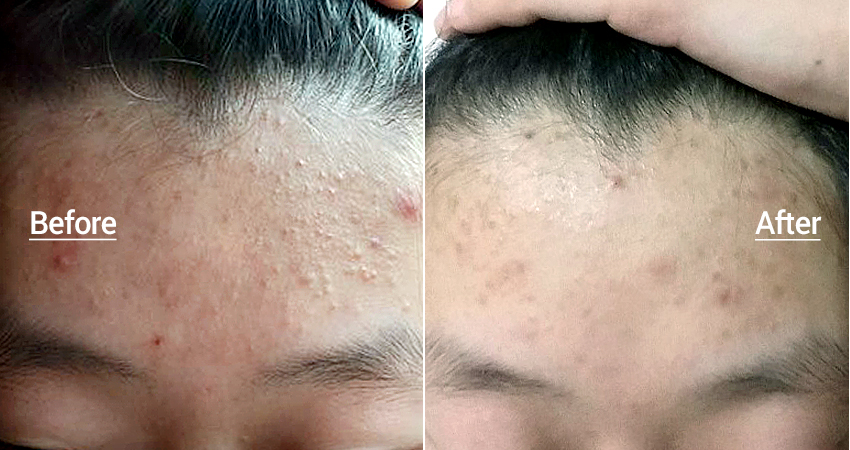 Image result for Cosrx One Step Moisture Up Pad 70pads