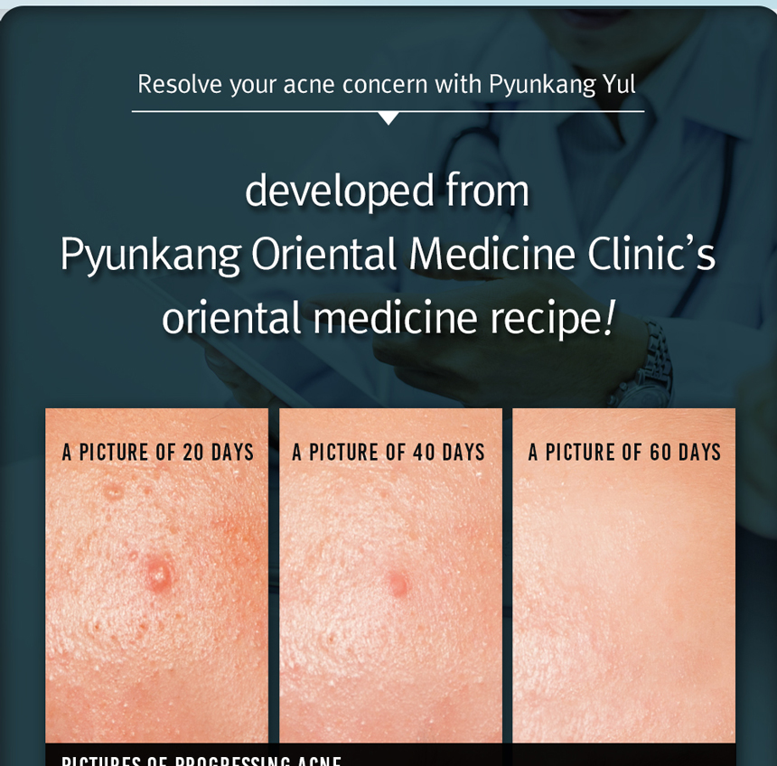 pyunkang acne spot cream